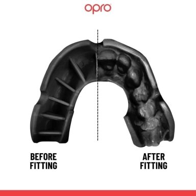 "OPRO" dantų apsauga Self-Fit UFC Bronze - Black