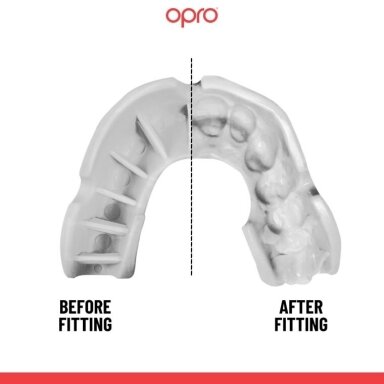 "OPRO" Mouthguard for Kids Self-Fit Bronze - White