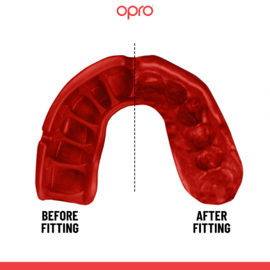"OPRO" dantų apsauga Self-Fit GEN5 Gold Jaws - Black/Red 1 "OPRO" dantų apsauga Self-Fit GEN5 Gold Jaws - Black/Red 1