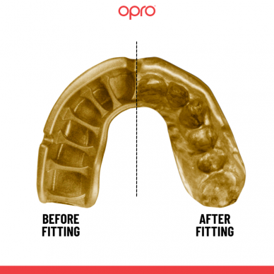 "OPRO" Mouthguard Self-Fit Gold - Black/Gold 1