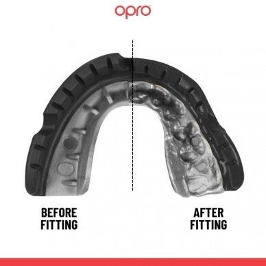 "OPRO" Mouthguard for Braces Self-Fit UFC Gold Braces - Black/Silver 1