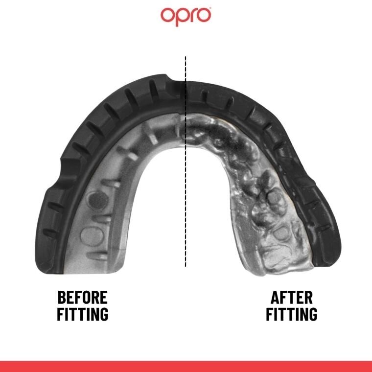 "OPRO" Mouthguard for Braces Self-Fit UFC Gold Braces - Black/Silver 1 "OPRO" Mouthguard for Braces Self-Fit UFC Gold Braces - Black/Silver 1